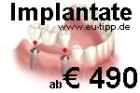 ZAHN-Behandlung in CZ -günstiger als Ungarn- Implantate 490 Euro